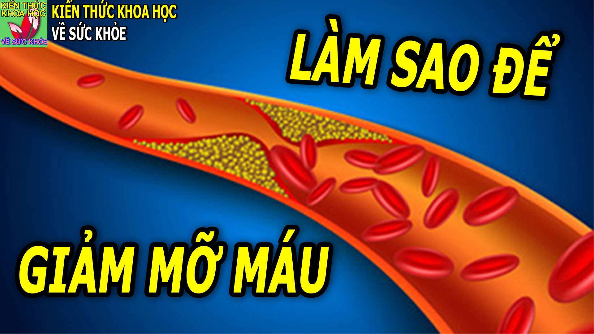 cach-giam-mo-mau-hieu-qua-nhat