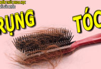 rung-toc-nhieu-bieu-hien-benh-gi