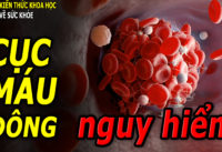 yeu-to-de-gay-dot-quy-khong-nhieu-nguoi-de-y