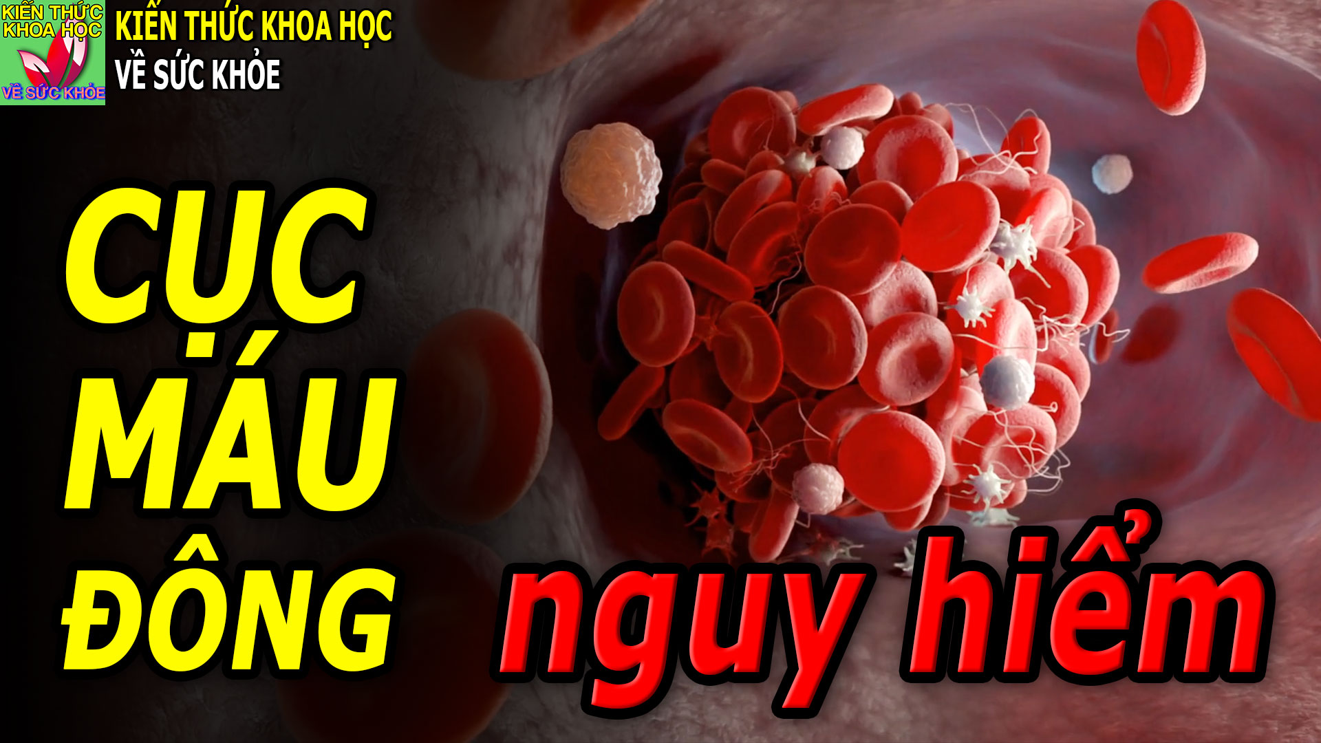 yeu-to-de-gay-dot-quy-khong-nhieu-nguoi-de-y