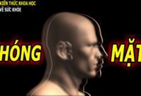 chong-mat-la-trieu-chung-gi-lam-sao-het-duoc