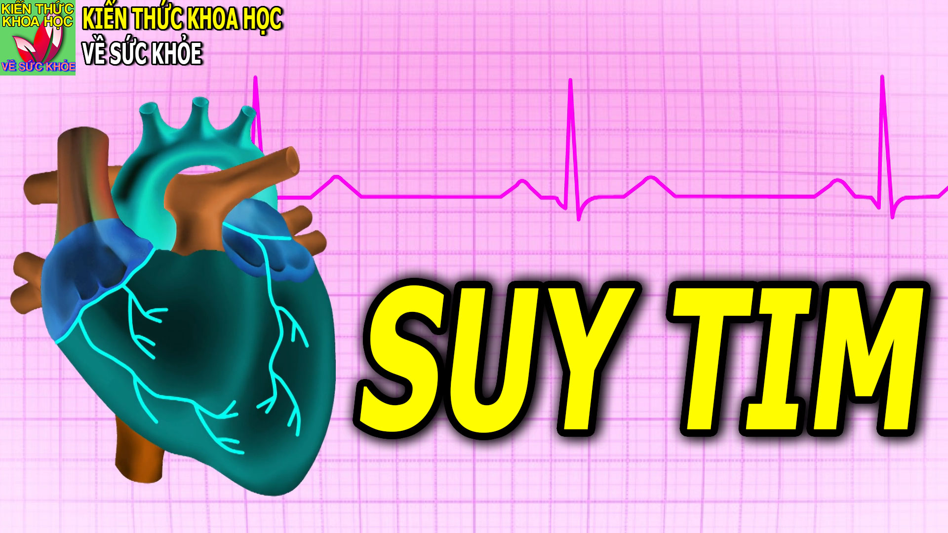 dau-hieu-trieu-chung-o-nguoi-mac-benh-suy-tim