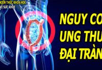 yeu-to-lam-tang-nguy-co-ung-thu-dai-truc-trang