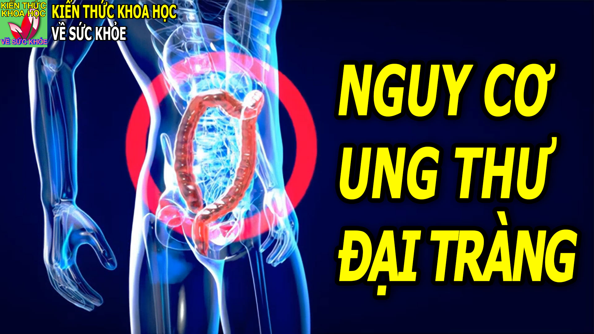 yeu-to-lam-tang-nguy-co-ung-thu-dai-truc-trang