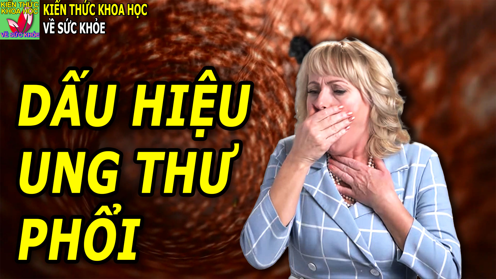 co-dau-hieu-nay-can-than-benh-ung-thu-phoi