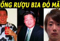 cu-uong-vao-la-bi-doi-mat-co-lam-sao-khong