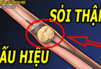 dau-hieu-nhan-biet-nguoi-bi-soi-than