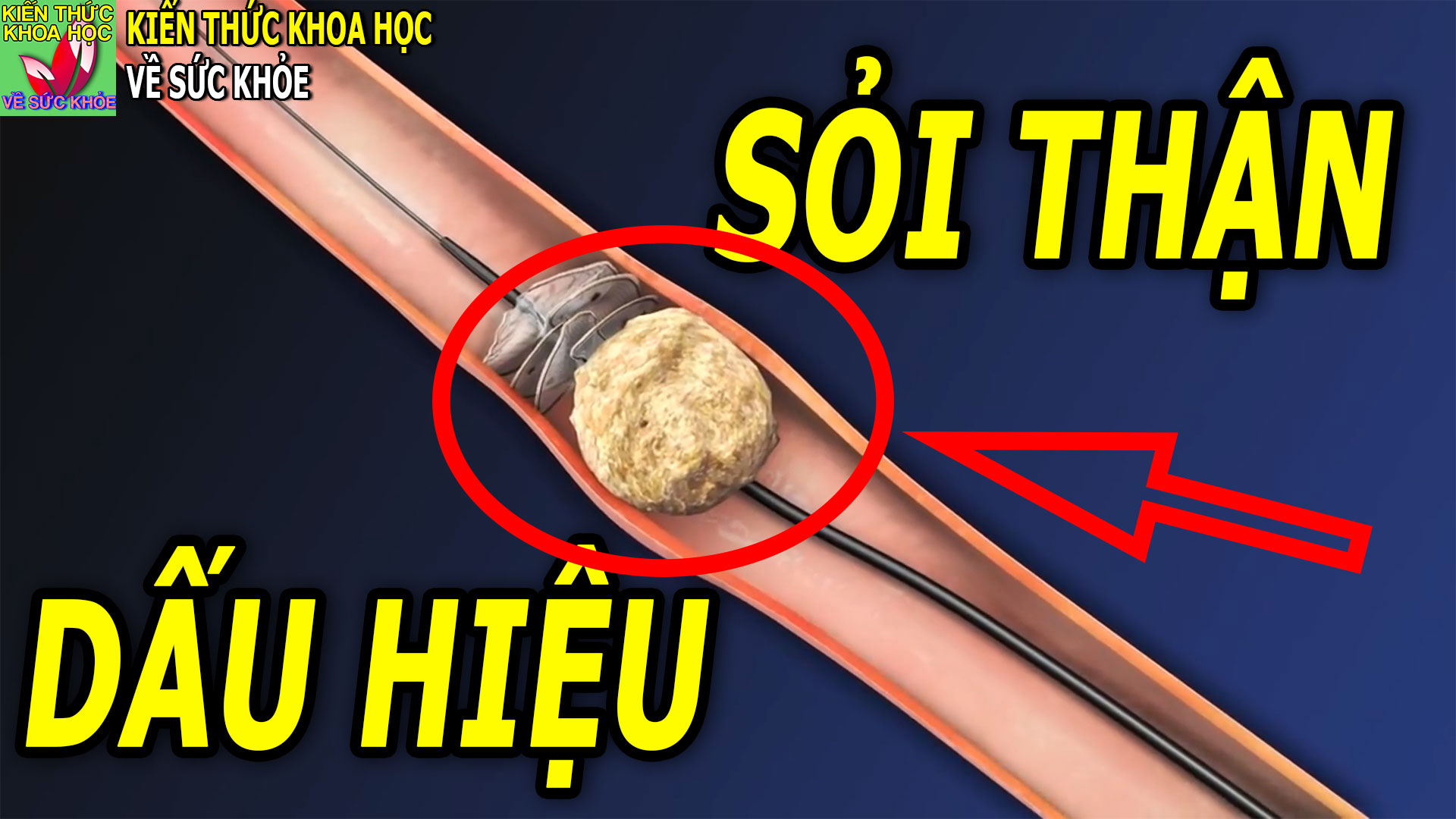 dau-hieu-nhan-biet-nguoi-bi-soi-than