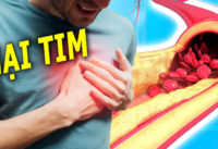 4-loai-thuc-pham-cang-an-nhieu-cang-de-mac-benh-tim