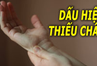 8-dau-hieu-thuong-gap-o-nguoi-an-uong-thieu-chat