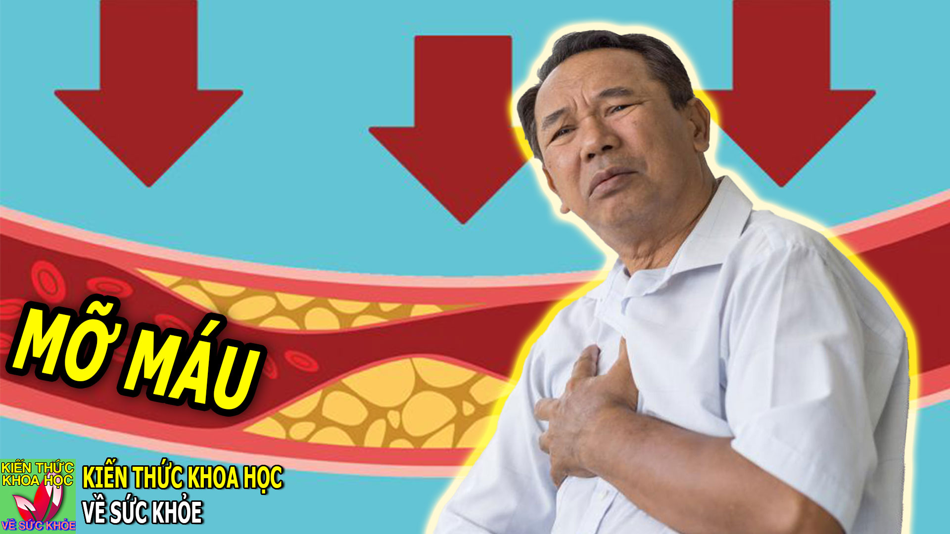 thoi-quen-gay-benh-mo-mau-lam-tang-nguy-co-dot-quy