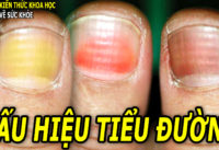 4-dau-hieu-o-mong-tay-co-the-canh-bao-som-benh-tieu-duong