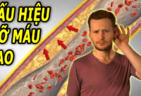 co-4-dau-hieu-nay-coi-chung-benh-mo-mau-cao