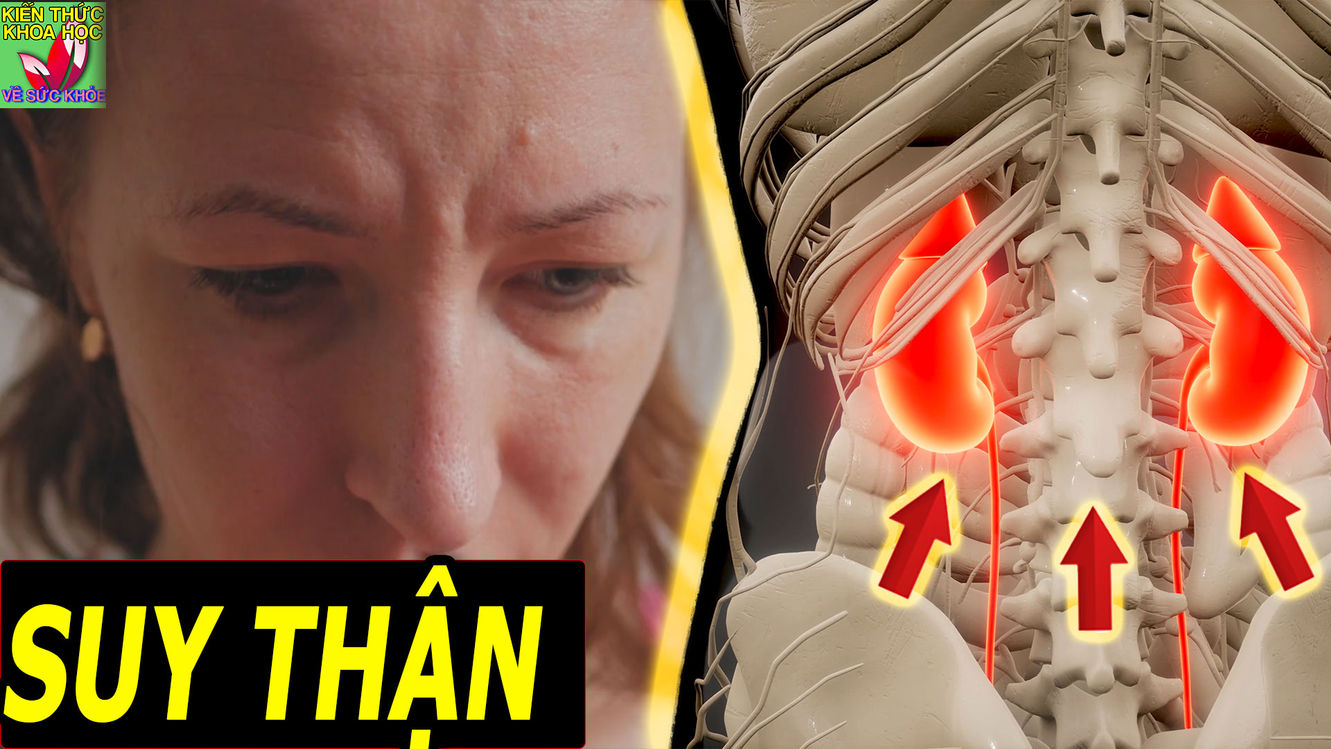 suy-than-rat-nhanh-vi-mot-nguyen-nhan-khong-ngo