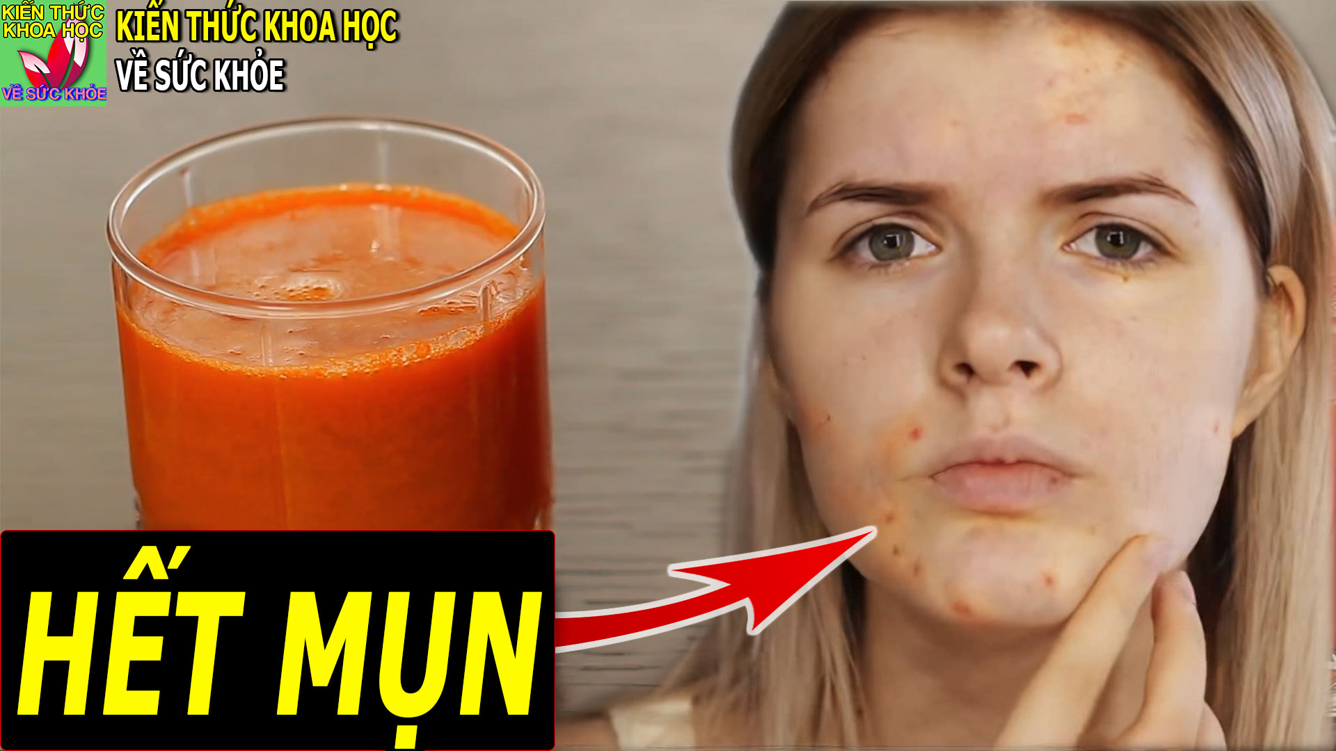 thuc-pham-thanh-nhiet-tieu-doc-tri-mun-nhot-cuc-hieu-qua