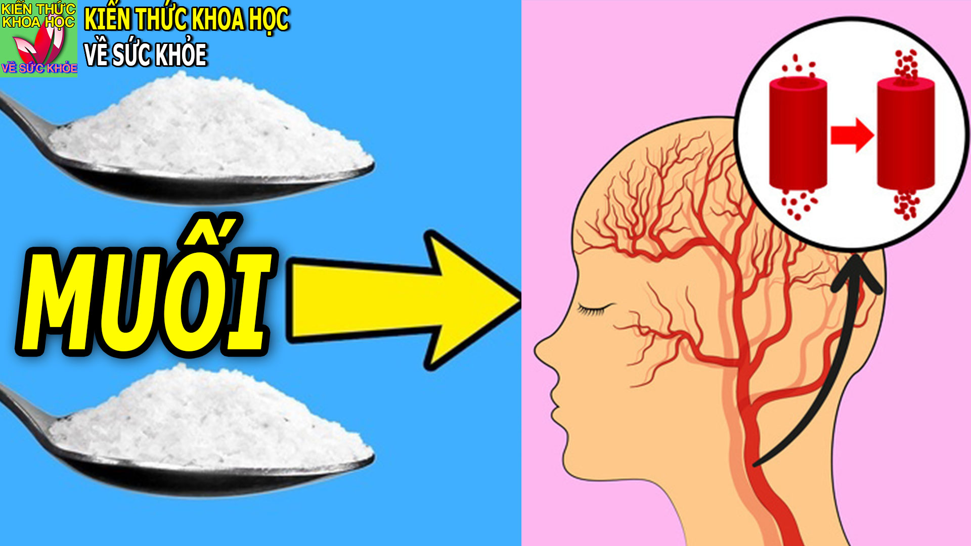 7-dau-hieu-nhan-biet-nguoi-an-qua-nhieu-muoi