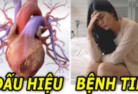 12-dau-hieu-benh-tim-de-bi-bo-qua