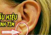 6-dau-hieu-tren-co-the-canh-bao-cac-van-de-tim-mach