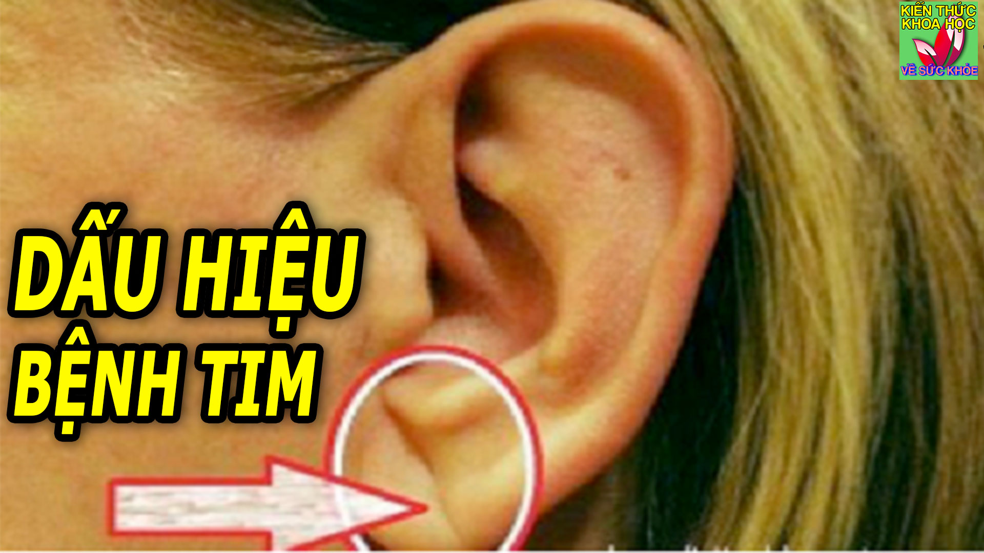 6-dau-hieu-tren-co-the-canh-bao-cac-van-de-tim-mach