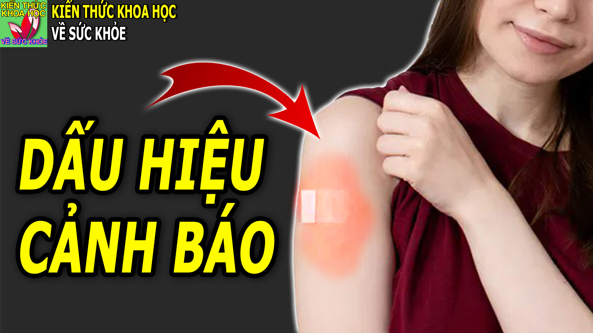 nhung-dieu-can-biet-sau-tiem-vac-xin-covid-19