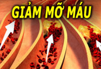 cach-giam-mo-mau-tu-nhien-chi-15-phut-moi-ngay