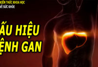 8-dau-hieu-cua-benh-gan-can-luu-y