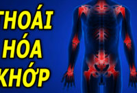 thoai-hoa-khop-nguyen-nhan-bieu-hien-va-cach-phong-ngua