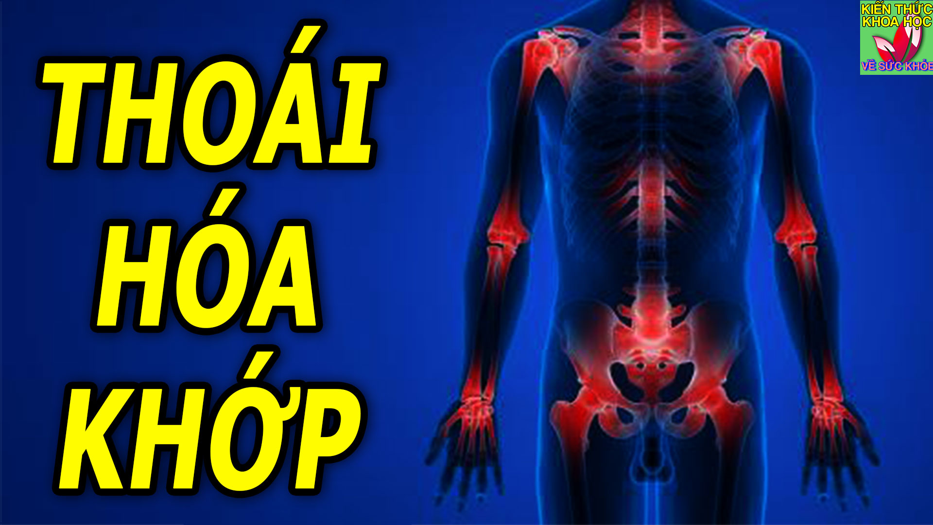 thoai-hoa-khop-nguyen-nhan-bieu-hien-va-cach-phong-ngua