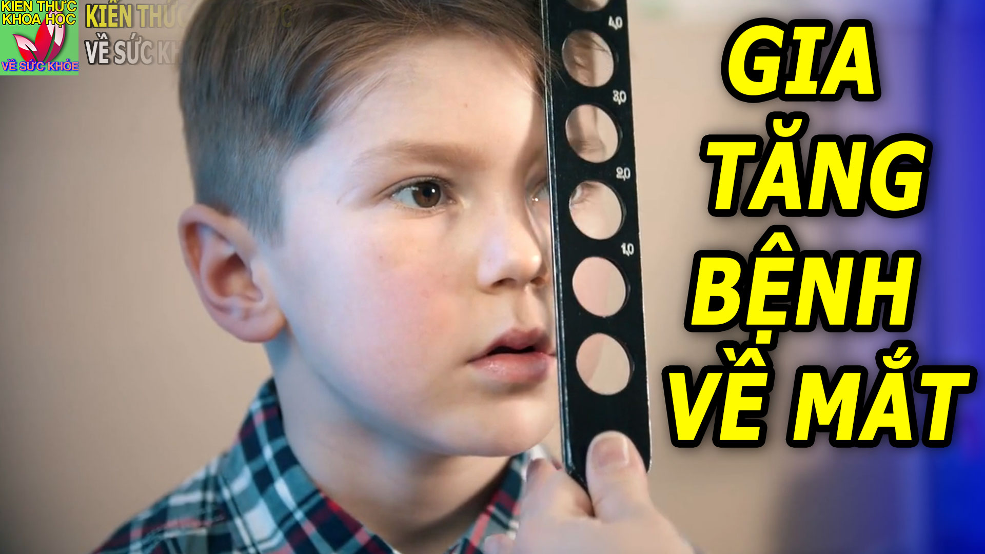 benh-ve-mat-ngay-cang-gia-tang-va-khong-ngung-tre-hoa