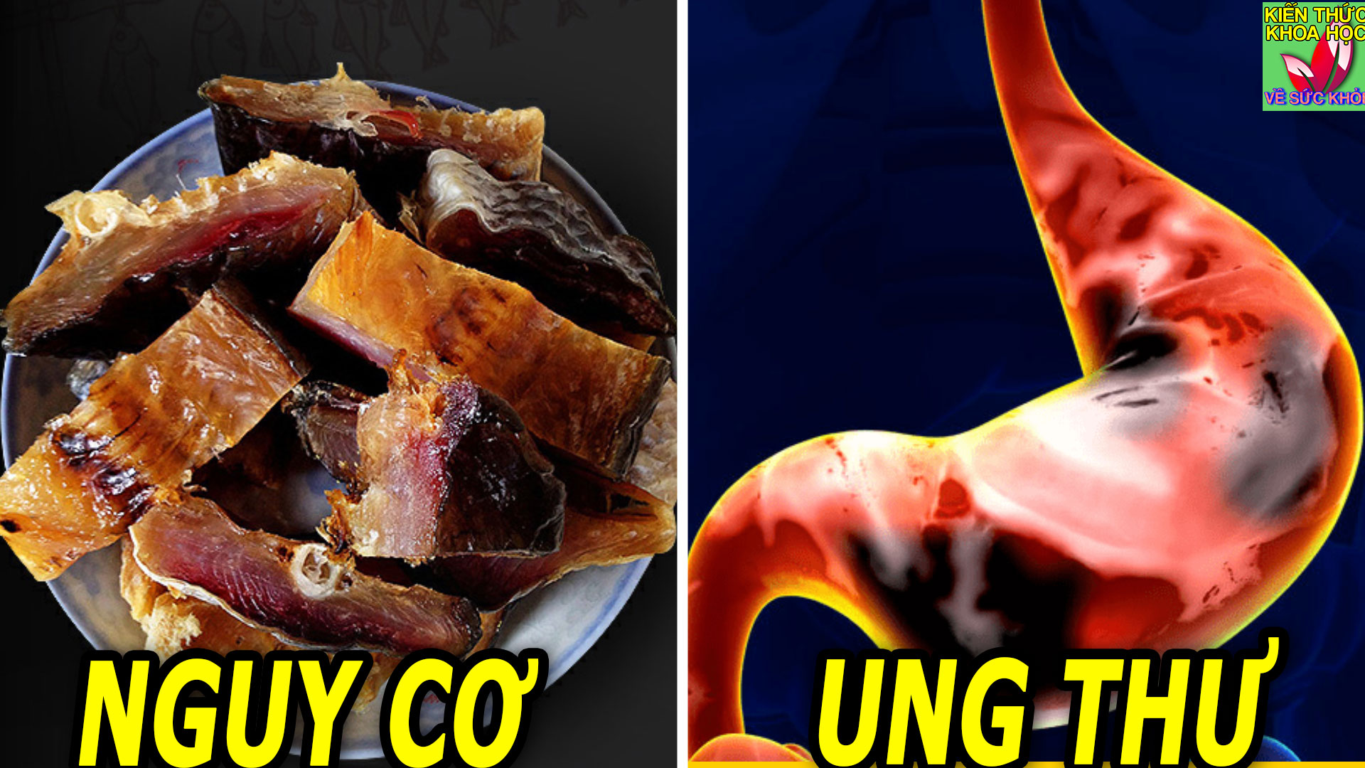 mon-ca-quen-thuoc-lot-danh-sach-nguy-co-ung-thu-hang-dau