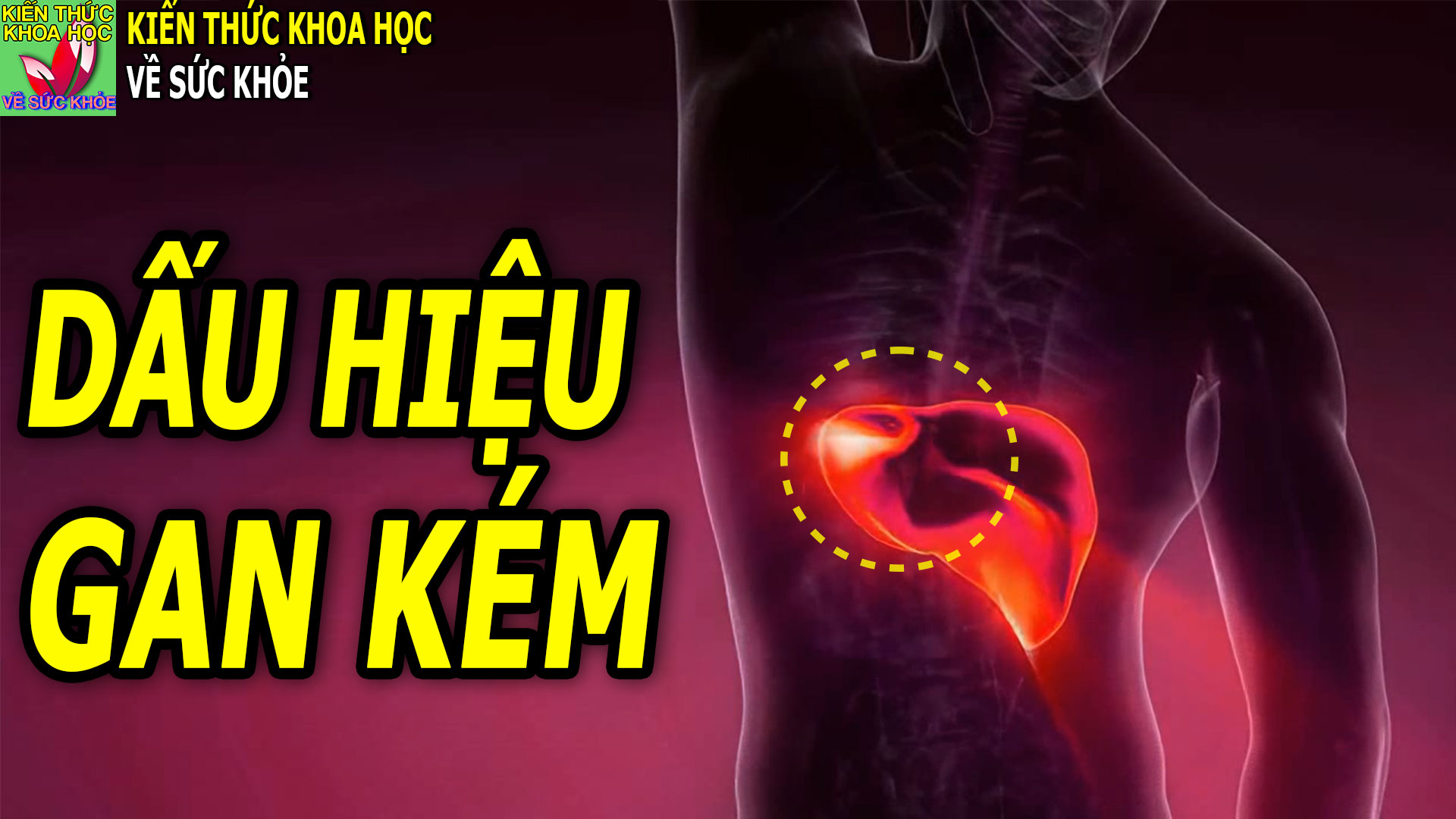 nguoi-gan-kem-co-the-thuong-phat-ra-2-cho-ngua-3-cho-den