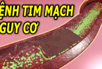 nhung-yeu-to-nguy-co-gay-benh-tim-mach-co-the-thay-doi-duoc