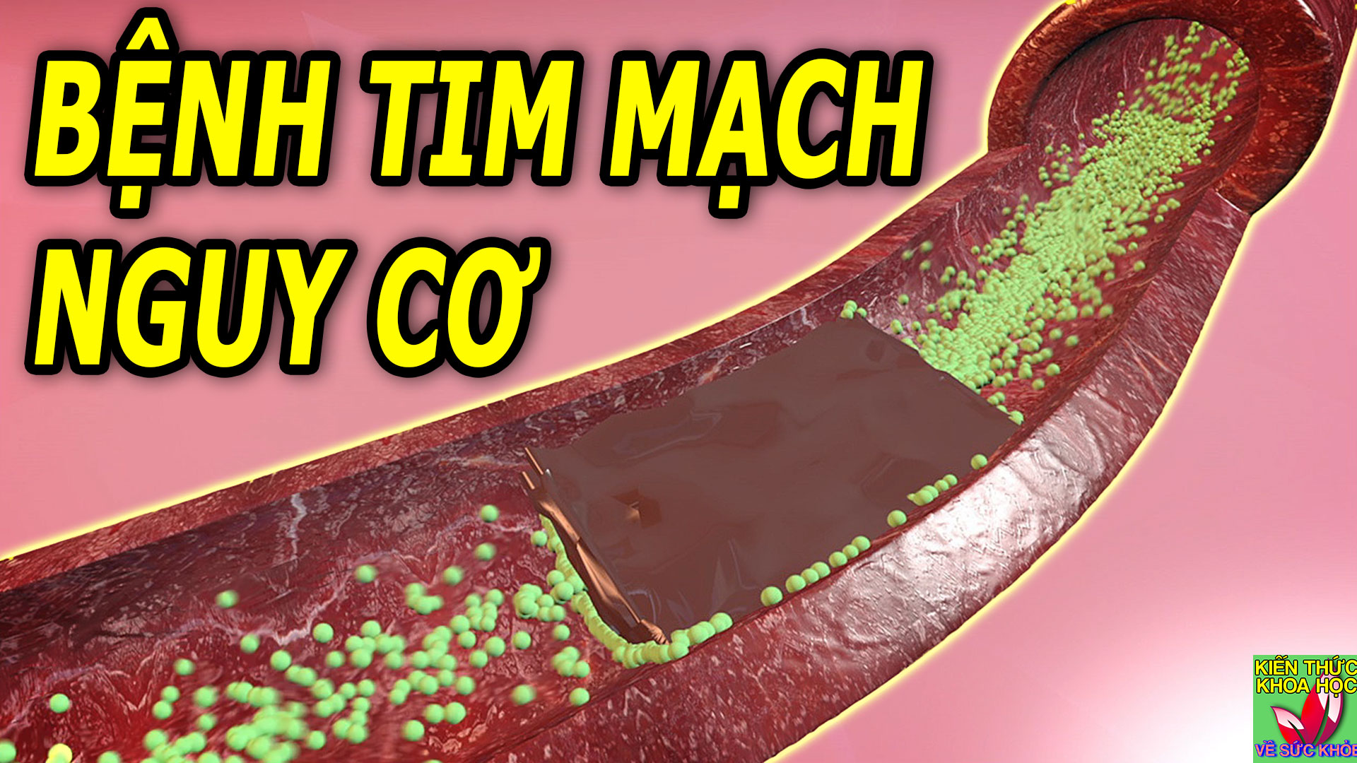 nhung-yeu-to-nguy-co-gay-benh-tim-mach-co-the-thay-doi-duoc