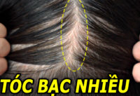 toc-bac-nhieu-nen-lam-gi-de-cai-thien