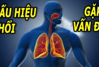 4-dau-hieu-canh-bao-phoi-co-van-de