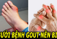nhung-luu-y-trong-an-uong-giup-kiem-soat-benh-gout