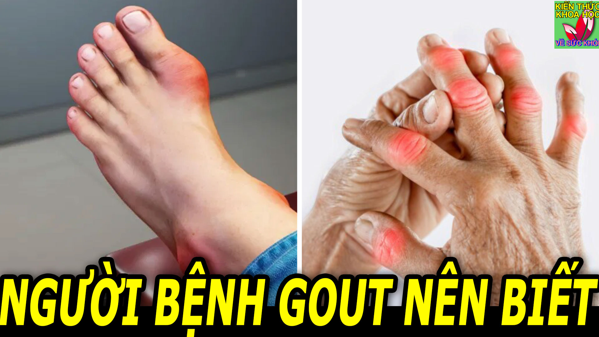 nhung-luu-y-trong-an-uong-giup-kiem-soat-benh-gout