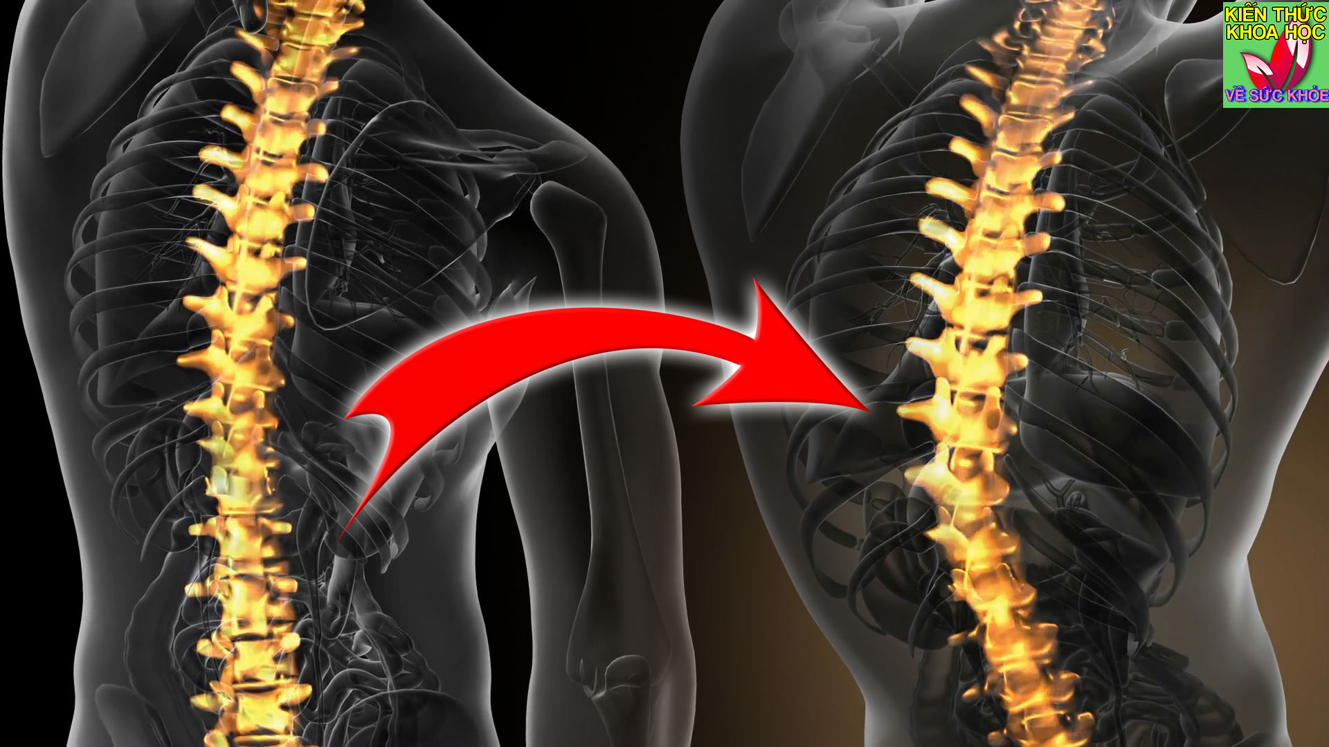 3-loai-thuc-pham-an-cang-nhieu-cang-de-bi-loang-xuong