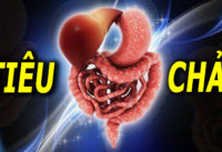 tieu-chay-nen-an-uong-the-nao-can-kieng-nhung-gitieu-chay-nen-an-uong-the-nao-can-kieng-nhung-gi