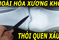 5-viec-cang-lam-xuong-khop-thoai-hoa-cang-nhanh