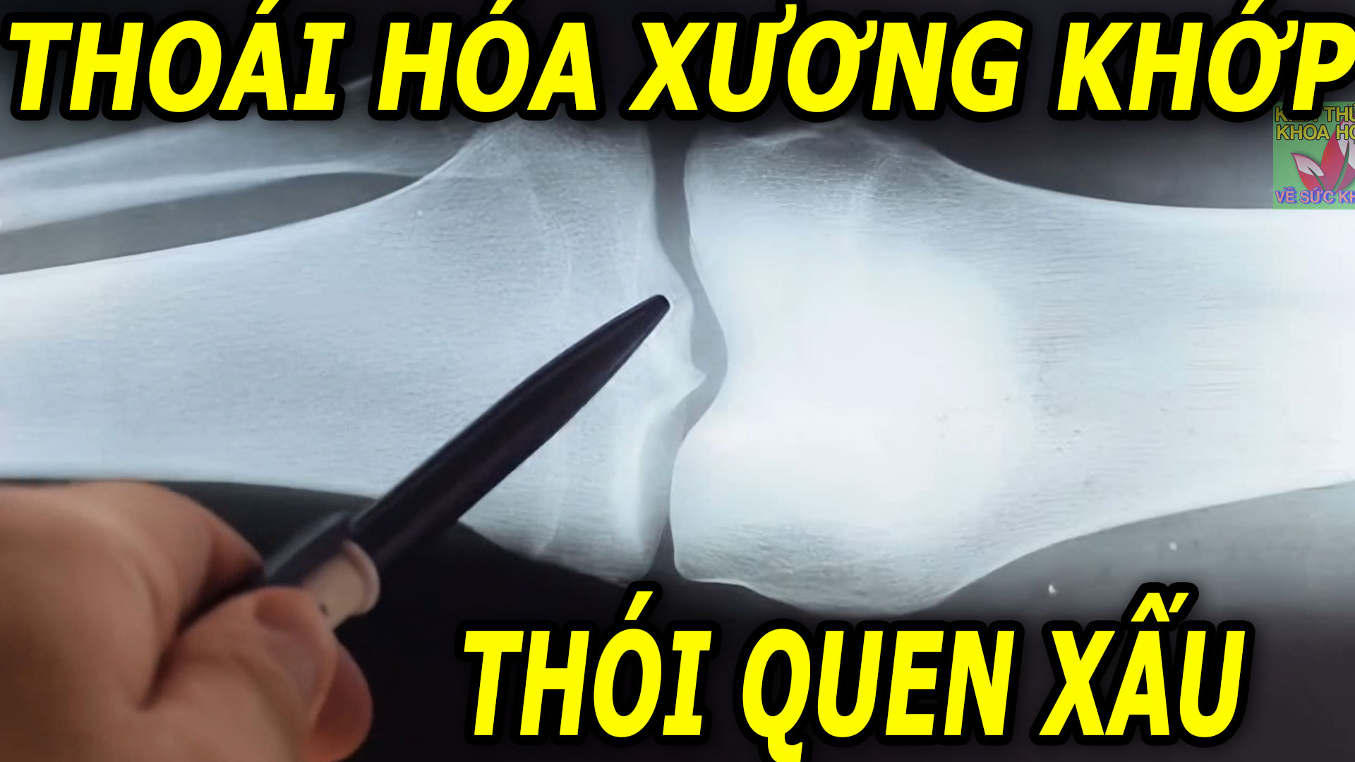 5-viec-cang-lam-xuong-khop-thoai-hoa-cang-nhanh