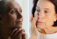 loai-qua-khac-tinh-cua-sa-sut-tri-tue-giup-chong-lao-hoa-lam-dep-da