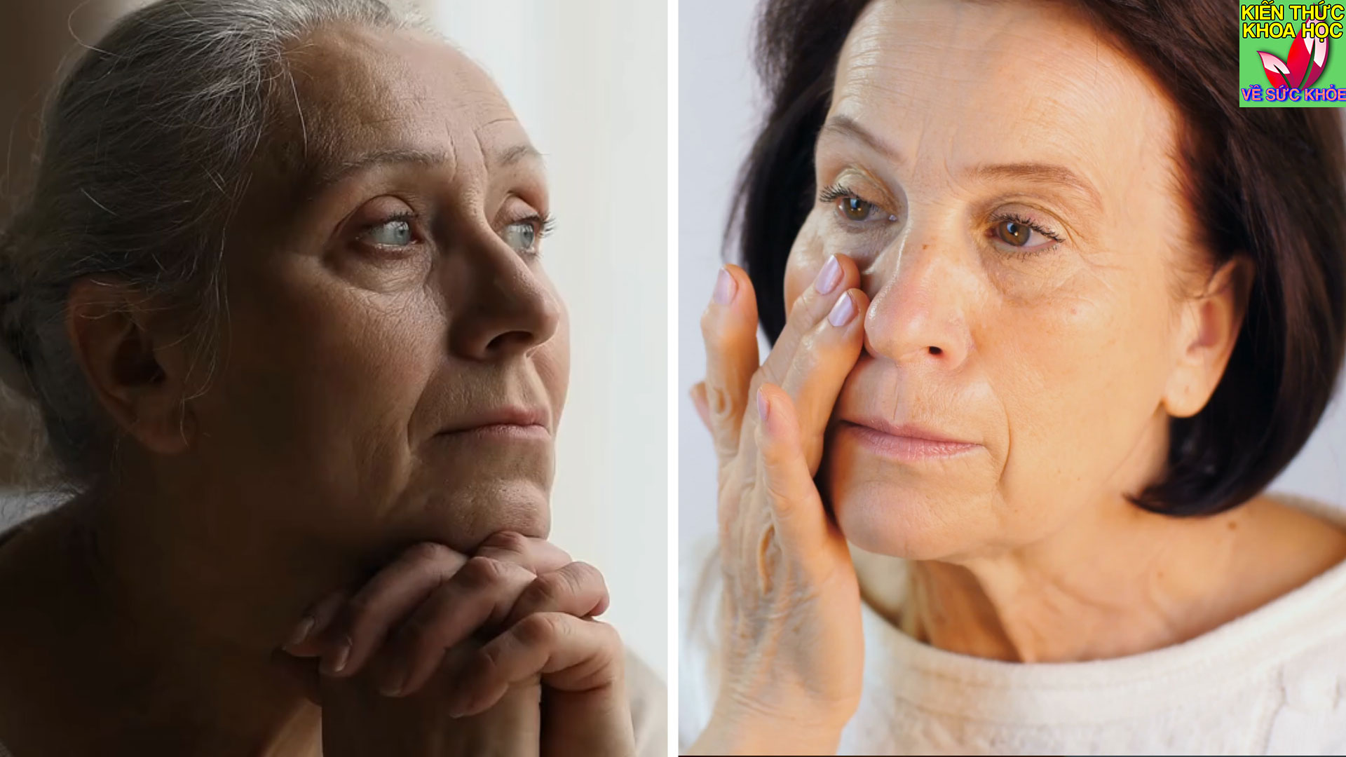 loai-qua-khac-tinh-cua-sa-sut-tri-tue-giup-chong-lao-hoa-lam-dep-da