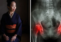 phu-nu-nhat-it-bi-loang-xuong-nho-thuong-xuyen-duy-tri-4-thoi-quen-nay