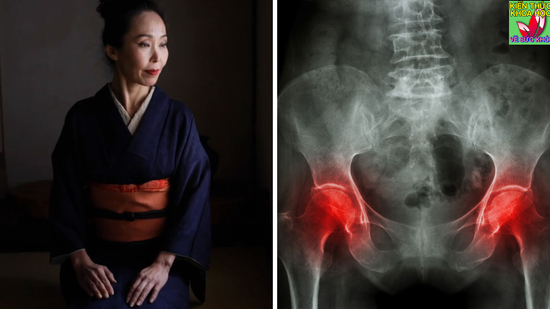 phu-nu-nhat-it-bi-loang-xuong-nho-thuong-xuyen-duy-tri-4-thoi-quen-nay