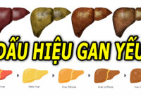 5-dau-hieu-o-nguoi-co-gan-yeu-kem-can-phai-chu-y
