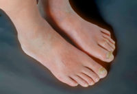 8-tin-hieu-canh-bao-benh-tieu-duong