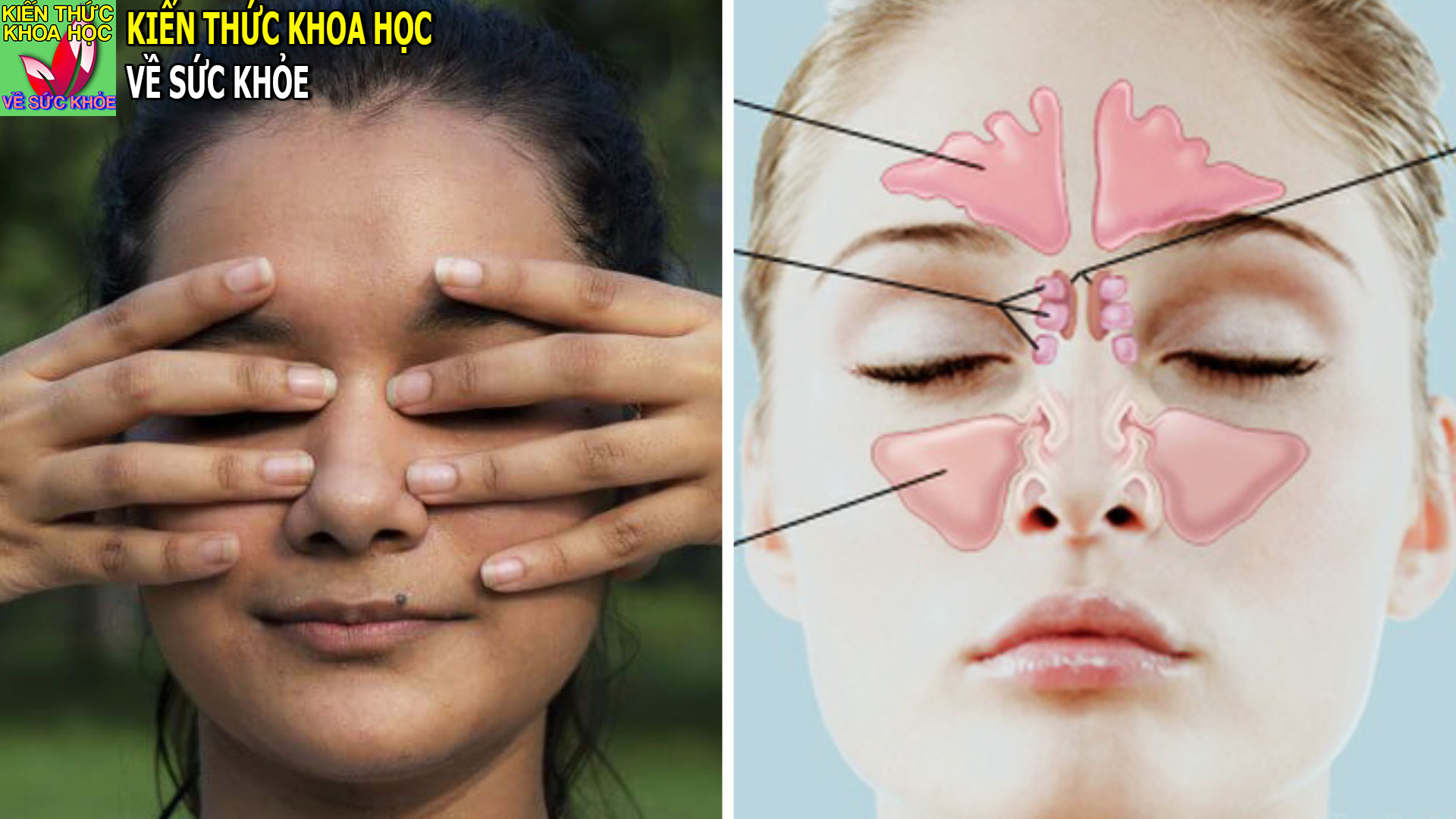 bai-tap-cai-thien-luu-thong-mau-ho-tro-dieu-tri-viem-xoang-man-tinh