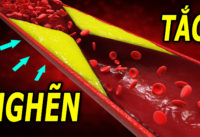 dau-hieu-mach-mau-bi-tac-nghen