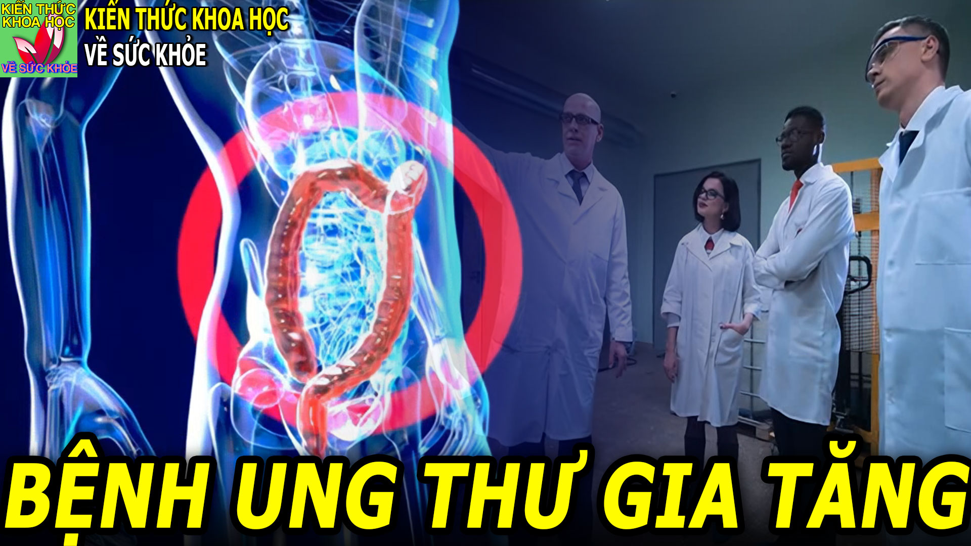 ung-thu-duong-tieu-hoa-dang-co-xu-huong-gia-tang-va-tre-hoa